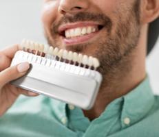 Veneers